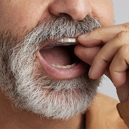 An oral appliance therapy