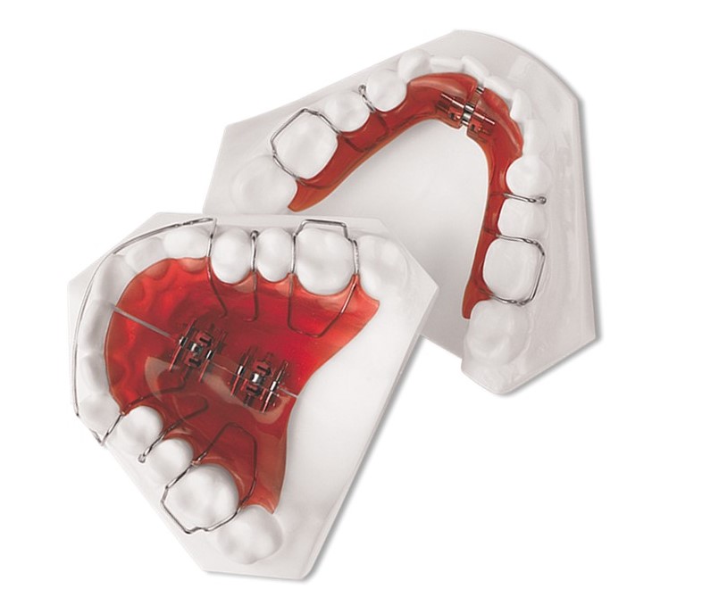 Illustration of airway expansion creating more space for breathing