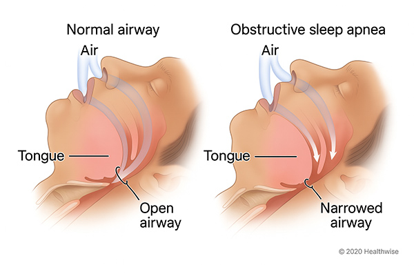 Airway expansion and facial growth treatment